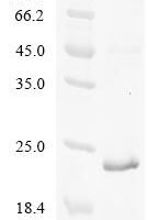 Human CDGSH iron-sulfur domain-containing protein 3, mitochondrial (CISD3) Recombinant Protein - BioCrest Sci