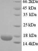 Human Ropporin-1B (ROPN1B) Recombinant Protein - BioCrest Sci