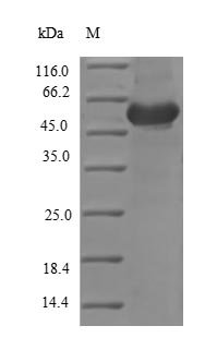Chicken Ovoinhibitor (OIH), partial Recombinant Protein, N-His, aa 26–472, Yeast, Gallus gallus (Chicken), Yeast, N-terminal 6xHis-tagged, 51.2 kDa, purity >≥ 90% as determined by SDS-PAGE.