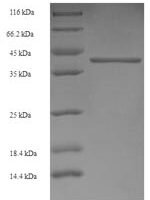 Human Gamma-aminobutyric acid receptor subunit alpha-4 (GABRA4), partial Recombinant Protein - BioCrest Sci