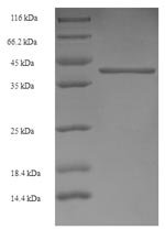 Human Gamma-aminobutyric acid receptor subunit alpha-4 (GABRA4), partial Recombinant Protein, Homo sapiens (Human), E.coli, N-terminal 6xHis-SUMO-tagged, 41.8 kDa, purity >≥ 90% as determined by SDS-PAGE.