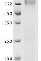 Mouse Pituitary homeobox 1 (Pitx1) Recombinant Protein, C-His, aa 1–315, Yeast - BioCrest Sci