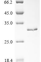 Mouse Amelogenin, X isoform (Amelx) Recombinant Protein - BioCrest Sci