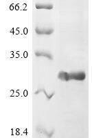 Human Vascular endothelial growth factor B (VEGFB), partial Recombinant Protein - BioCrest Sci