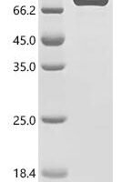 Human Serine/threonine-protein kinase ATR (ATR), partial, Biotinylated Recombinant Protein - BioCrest Sci