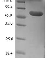 Human Extended synaptotagmin-1 (ESYT1), partial,Escherichia Coli Recombinant Protein - BioCrest Sci