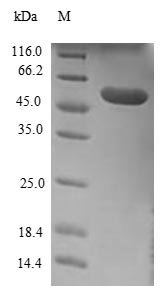 Human Extended synaptotagmin-1 (ESYT1), partial,Escherichia Coli Recombinant Protein, Homo sapiens (Human), E.coli, N-terminal GST-tagged, 53.7 kDa, purity >≥ 90% as determined by SDS-PAGE.