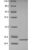 Human NHP2-like protein 1 (NHP2L1) Recombinant Protein - BioCrest Sci