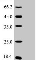 Human Prothymosin alpha (PTMA) Recombinant Protein, N-His - BioCrest Sci
