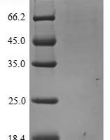 Rat Beta-nerve growth factor (Ngf) Recombinant Protein, N-His - BioCrest Sci