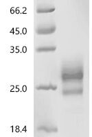 Human E3 ubiquitin-protein ligase RNF43 (RNF43), partial Recombinant Protein, C-10His - BioCrest Sci