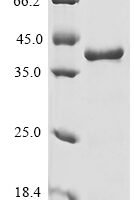 Enterobacteria phage PRD1 Spike protein P5 (V) Recombinant Protein, N-His - BioCrest Sci