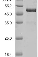 Human Transmembrane protein PVRIG (PVRIG), partial, Biotinylated Recombinant Protein - BioCrest Sci