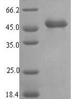 Pseudomonas aeruginosa Elastase (lasB) Recombinant Protein, N-His-SUMO - BioCrest Sci