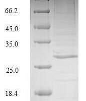 Human Complement C1q tumor necrosis factor-related protein 3 (C1QTNF3) Recombinant Protein - BioCrest Sci