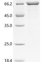 Human Keratin, type II cytoskeletal 2 epidermal (KRT2) Recombinant Protein - BioCrest Sci