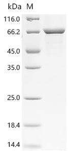 Human Keratin, type II cytoskeletal 2 epidermal (KRT2) Recombinant Protein, Homo sapiens (Human), E.coli, C-terminal 6xHis-tagged, 72.3 kDa, purity >≥ 85% as determined by SDS-PAGE.