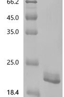 Human Tumor necrosis factor (TNF), partial, Biotinylated Recombinant Protein - BioCrest Sci