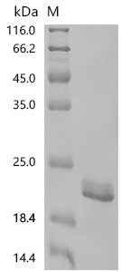Human Tumor necrosis factor (TNF), partial, Biotinylated Recombinant Protein, Homo sapiens (Human), Mammalian cell, C-terminal 10xHis-Avi-tagged, 21.1 kDa, purity >≥ 95% as determined by SDS-PAGE.≥ 95% as determined by SEC-HPLC.