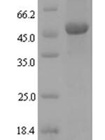 Xanthomonas campestris pv. campestris NAD-dependent protein deacetylase (cobB) Recombinant Protein - BioCrest Sci