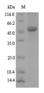 Xanthomonas campestris pv. campestris NAD-dependent protein deacetylase (cobB) Recombinant Protein, Xanthomonas campestris pv. campestris (strain B100), E.coli, N-terminal 6xHis-SUMO-tagged, 48.1 kDa, purity >≥ 90% as determined by SDS-PAGE.