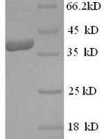 Human Mast cell carboxypeptidase A (CPA3) Recombinant Protein, N-His, aa 110–417, Yeast - BioCrest Sci