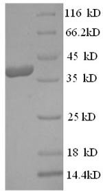 Human Mast cell carboxypeptidase A (CPA3) Recombinant Protein, N-His, aa 110–417, Yeast, Homo sapiens (Human), Yeast, N-terminal 6xHis-tagged, 38.0 kDa, purity >≥ 90% as determined by SDS-PAGE.