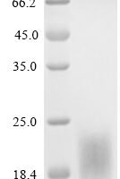 Human Transmembrane protein 119 (TMEM119), partial Recombinant Protein - BioCrest Sci