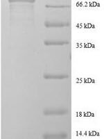 Human EF-hand domain-containing protein KIAA0494 (KIAA0494), partial Recombinant Protein - BioCrest Sci