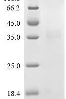 Macaca fascicularis Kallikrein related peptidase 5 (KLK5), partial Recombinant Protein, C-10His - BioCrest Sci