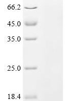 Apis mellifera Allergen Api m 6.03 / Api m 6.04 Recombinant Protein - BioCrest Sci