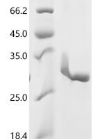 Human Focadhesin (FOCAD), partial Recombinant Protein, C-10His - BioCrest Sci