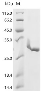 Human Focadhesin (FOCAD), partial Recombinant Protein, C-10His, Homo sapiens (Human), E.coli, C-terminal 10xHis-tagged, 26.6 kDa, purity >≥ 95% as determined by SDS-PAGE.
