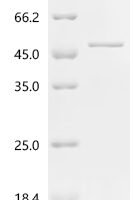 Spinacia oleracea Phosphoribulokinase, chloroplastic Recombinant Protein, C-His, aa 52–402, E.coli - BioCrest Sci