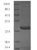 Influenza A virus Hemagglutinin (HA) (X347S,X348S,X509S,X538S), partial Recombinant Protein - BioCrest Sci