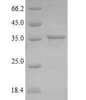 Mycobacterium tuberculosis Adenylate kinase (adk) Recombinant Protein - BioCrest Sci