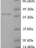 Human Transmembrane protein 14B (TMEM14B) Recombinant Protein - BioCrest Sci