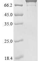 Escherichia coli DNA gyrase subunit A (gyrA) (D87G) Recombinant Protein - BioCrest Sci