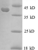 Escherichia coli 30S ribosomal protein S10 (rpsJ) Recombinant Protein - BioCrest Sci