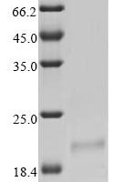 Bovine coronavirus Non-structural protein of 12.7 kDa (5a) Recombinant Protein - BioCrest Sci