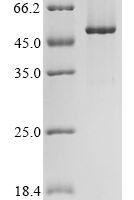 Human WD repeat and FYVE domain-containing protein 1 (WDFY1) Recombinant Protein - BioCrest Sci