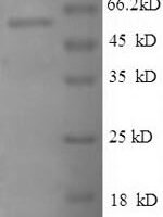 Human 60S ribosomal protein L3 (RPL3), partial Recombinant Protein - BioCrest Sci