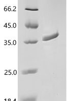 Human Proliferating cell nuclear antigen (PCNA) Recombinant Protein - BioCrest Sci