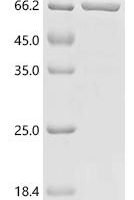 Human Neuronal acetylcholine receptor subunit alpha-9 (CHRNA9), partial, Biotinylated Recombinant Protein - BioCrest Sci