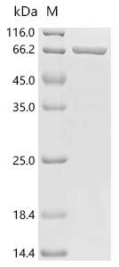 Human Neuronal acetylcholine receptor subunit alpha-9 (CHRNA9), partial, Biotinylated Recombinant Protein, Homo sapiens (Human), E.coli, N-terminal MBP-tagged and C-terminal 6xHis-Avi-tagged, 72.2 kDa, purity >≥ 85% as determined by SDS-PAGE.