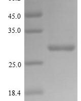 Influenza A virus Polymerase acidic protein (PA), partial Recombinant Protein - BioCrest Sci