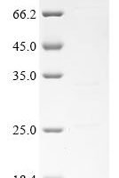 Cat Major allergen I polypeptide chain 1 (CH1) Recombinant Protein - BioCrest Sci