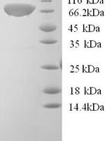 Human Calpastatin (CAST) Recombinant Protein, N-His, aa 1–667, Yeast - BioCrest Sci