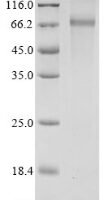 Human Pyruvate dehydrogenase E1 component subunit alpha, somatic form, mitochondrial (PDHA1), partial Recombinant Protein, N-His-GST - BioCrest Sci