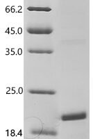 Human Thyrotropin subunit beta (TSHB) Recombinant Protein - BioCrest Sci